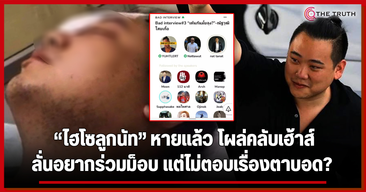 อาจมีคดีพลิก!? "ไฮโซลูกนัท" ออกจาก ICU โผล่กลางคลับเฮ้าท์ ...